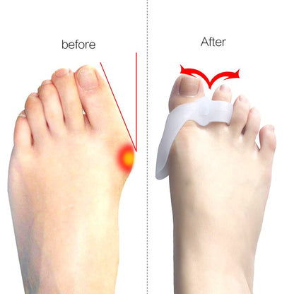 Soft Gel Bunion Corrector Hallux Valgus Stretcher Thumb Bone Adjuster